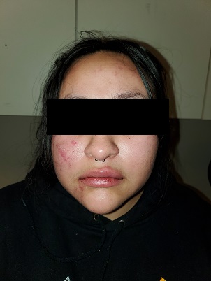 Victim Injuries